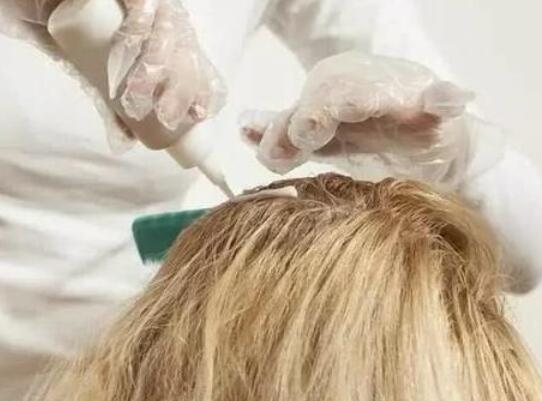 染发剂弄到头皮上有伤害吗(染发对头皮有伤害吗)